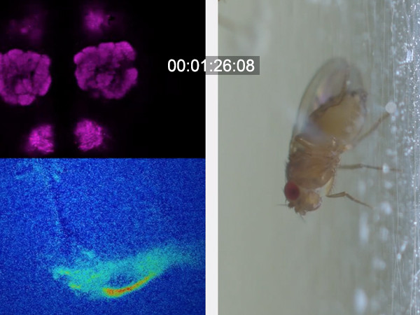 Visualization of Neural Activity in the Brain