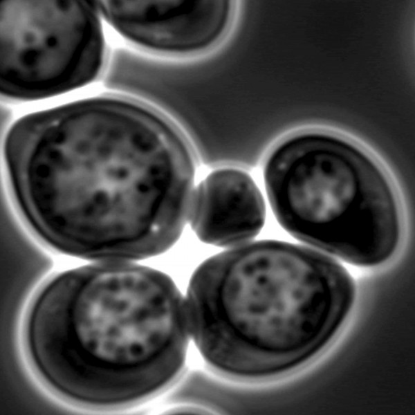 オートファジーを起こしている出芽酵母細胞